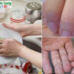 3 thói quen rửa chén bát sai lầm gây hủy hoại da tay