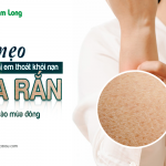 9 mẹo giúp chị em thoát khỏi nạn “da rắn” vào mùa đông