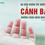 Da đầu ngón tay nhăn nheo, cảnh báo những căn bệnh nguy hiểm