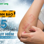 Cảnh báo: 5 căn bệnh da liễu nguy hiểm dễ gặp vào mùa lạnh