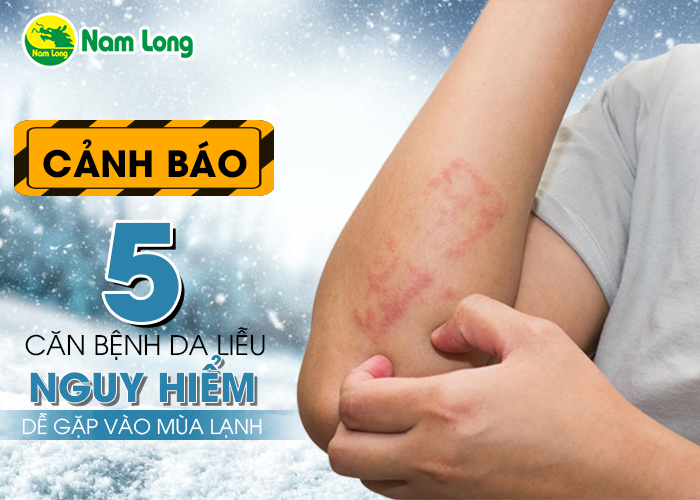 5 căn bệnh da liễu - 01