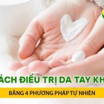 Cách điều trị da tay khô bằng 4 phương pháp tự nhiên