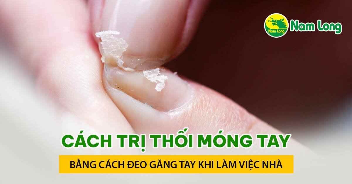 cach tri thoi mong tay tai nha