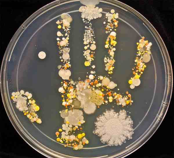 5 loại vi khuẩn có hại cho tay
